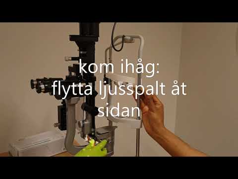 spaltlampa Del 2 undersökning