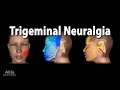 Trigeminal Neuralgia (Tic Douloureux), Animation