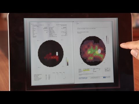 Bardet Bield Syndrome - Retinitis Pigmentosa Treatment - 19 years patient from Saudi Arabia ( Medical results) Part 2