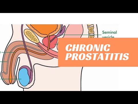 Prostatitis jóindulatú