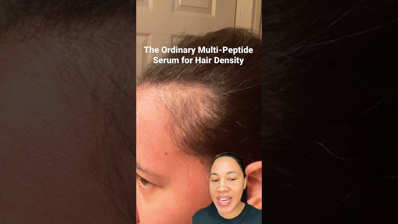 🤩 The Ordinary Multi-Peptide Serum for Hair Density. #hairgrowth #theordinary #hairloss