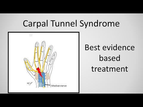 Carpal tunnel szindróma Carpal ízületi kezelés