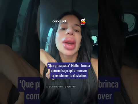 ‘Que presepada’: Mulher brinca com inchaço após remover preenchimento dos lábios