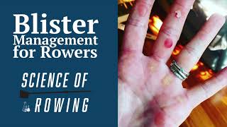 Blister Management for Rowers