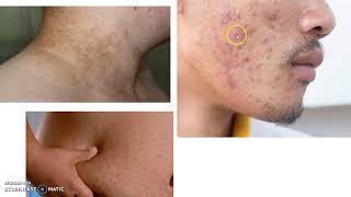 Carné del adolescente I