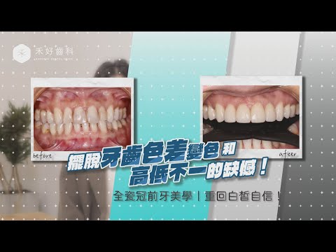 - YouTube
