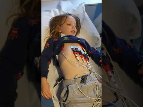 Child's ecg