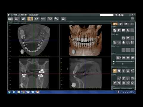 Morita i-Dixel 01 Operation