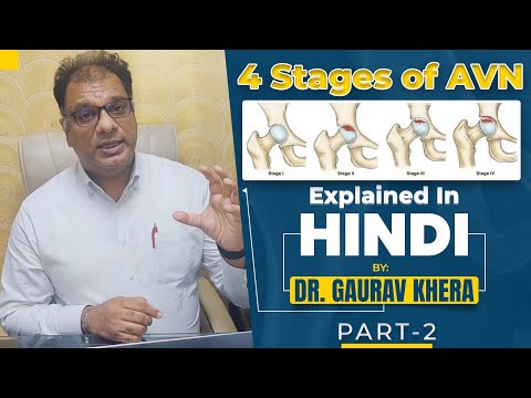 Osteonecrosis Of The Hip Ficat Classification | AVN 4 Stages Explained in Hindi