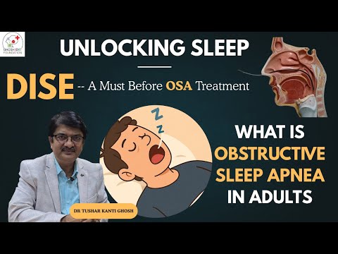 Unlocking Sleep: DISE - A Must Before OSA Treatment | Obstructive Sleep APNEA | Dr. T. K. GHOSH