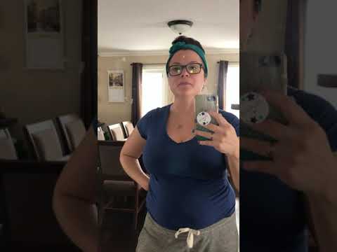 Umbilical Hernia Repair surgery. 3 weeks post-op. March 1st, 2021 All better!!!