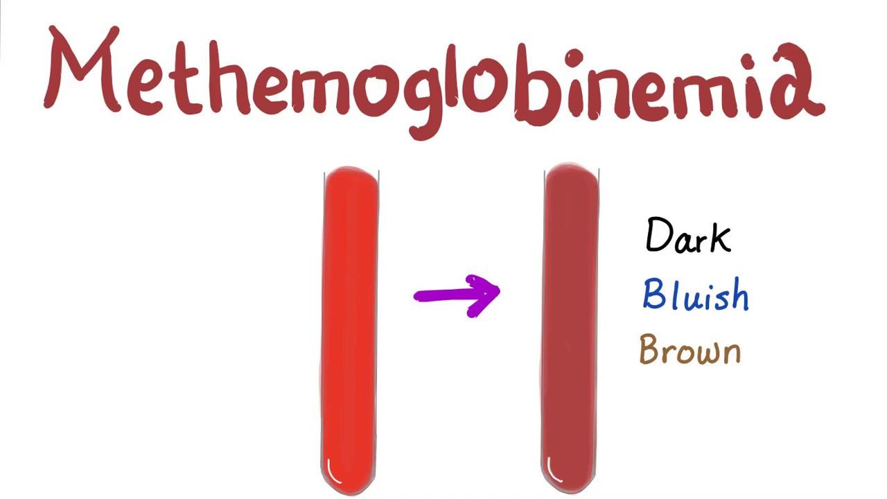 What is the color of blood with methemoglobin?