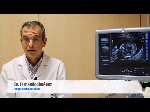 🤰Ultrasound at week 12 of pregnancy, I'll explain everything you need to know