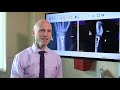 Broken Wrists Fracture Types Treatment Options Recovery Dr Froelich