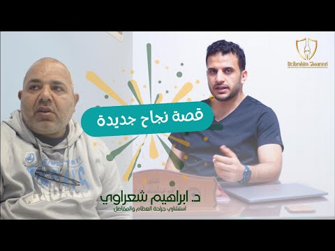 نجاح عملية قرحة بسطح المفصل بالمنظار مع دكتور ابراهيم شعراوي