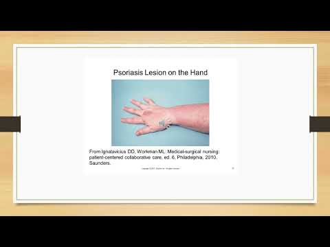 Chapter 43  Care of patients with integumentary disorders and burns