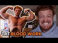 My Blood Test Results Before Using Steroids... Again.