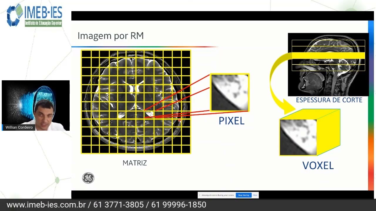 Formação de imagem em Ressonância Magnética - Qual a função dos gradientes | GE HealthCare Brasil
