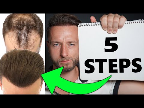 Follow THIS To Get The Best Hair Transplant Result in...