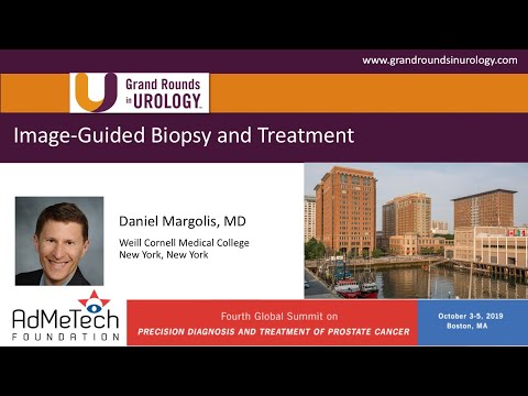 Image Guided Biopsy and Treatment of Prostate Cancer