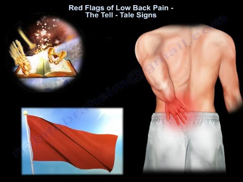 Rote Fahnen von Rückenschmerzen, wenn Sie anfangen, sich Sorgen zu machen - Alles, was Sie wissen müssen - Dr. Nabel Ebraheim