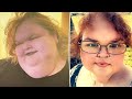 1000-Lb. Sisters ' Tammy Slaton Shares Photos of Her Dramatic Weight Loss