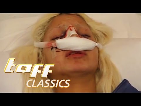 Mimi and Pinar - Nose Surgery Part 1 | taff classics | ProSieben