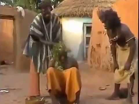 Tratamiento Africano Para La Calvicie