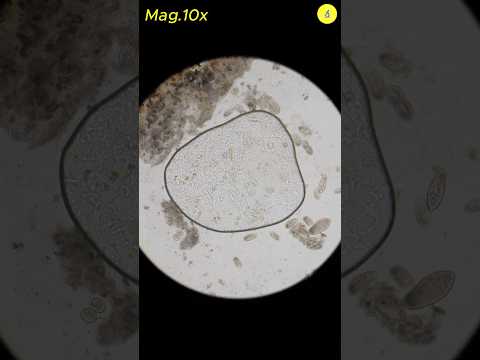 Hydrogen Peroxide vs Bacteria Under Microscope | TULO - Microscope #shrots #bacteria #microscope