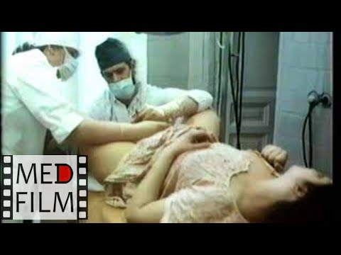 Разрыв шейки матки, влагалища, промежности © Rupture of the cervix, vagina, perineum