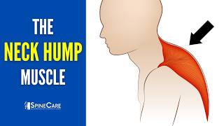 Release THIS Muscle to Fix Your Neck Hump