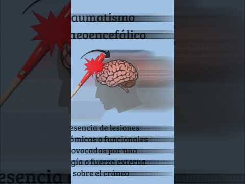 Ejercicio de Marcha y coordinación en persona con accidente cerebro vascular (ICTUS)
