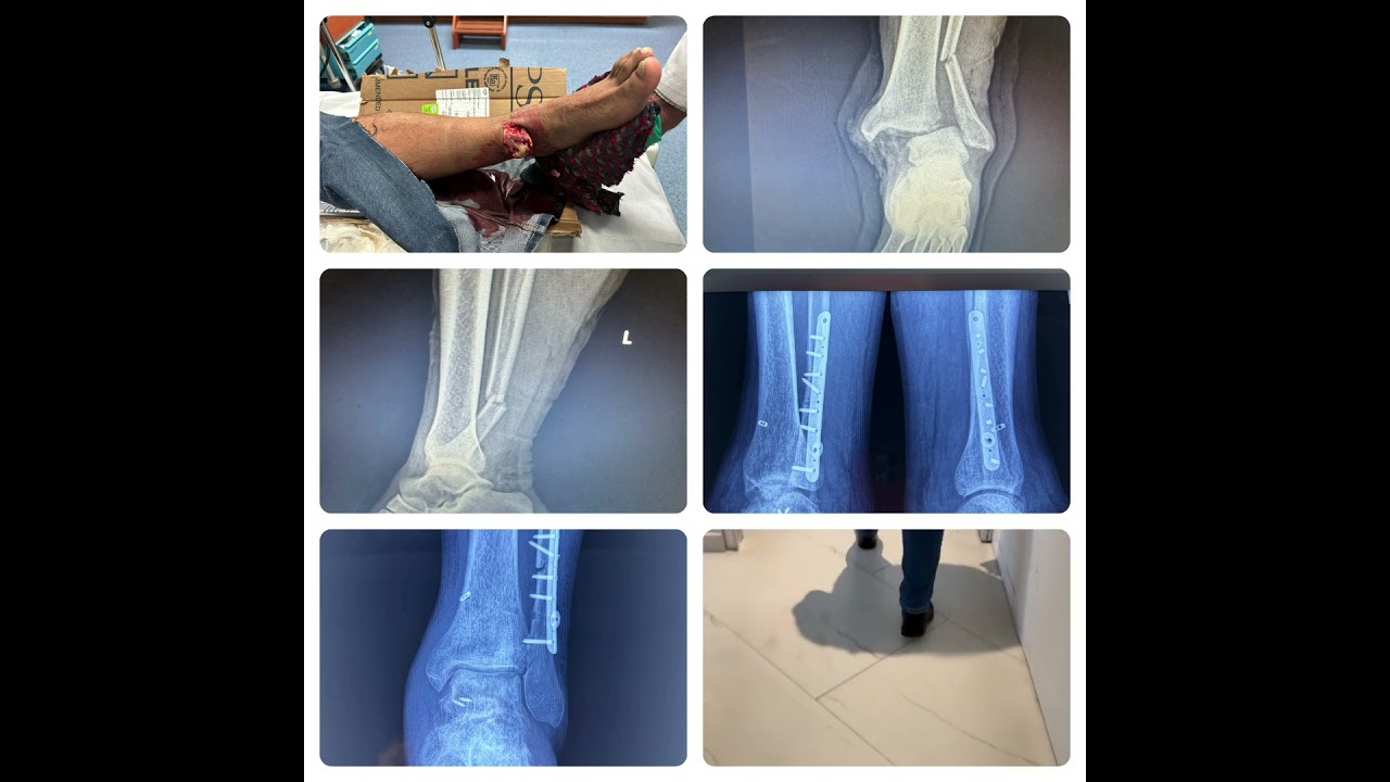 Diego Gomez Orozco-11