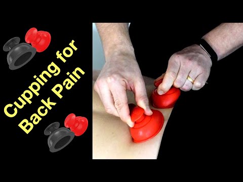 The best way to cup for back pain | RockPods to reduce back pain. The best way!