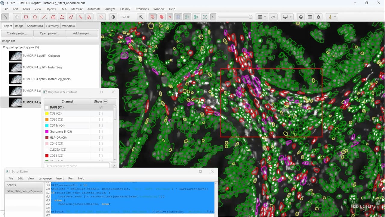Practical Considerations for Using InstanSeg v Cellpose in QuPath for Multiplex Immunofluorescence