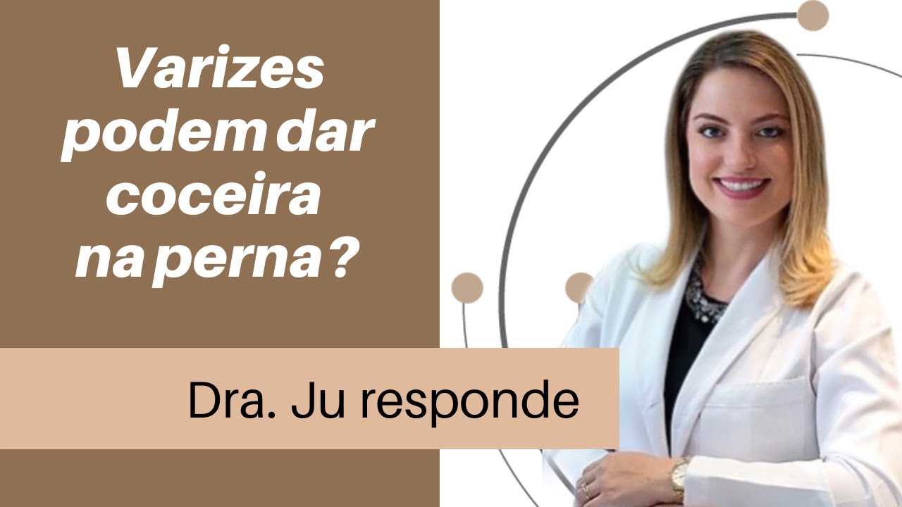 Varizes podem causar coceira nas pernas