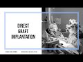 Direct Graft Implantation is one of the most advanced methods to implant hair.