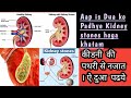 Kidney Stones Gallbladder Stones Ko Khatam Karne Ki Dua Shorts Viral Trending Short Shortsvideo