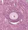 Shotgun Histology Ovary
