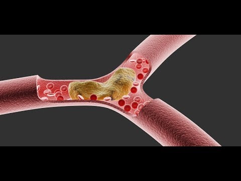 Obat anti-impotensi untuk diabetes Obat-obatan dengan potensi yang lebih rendah