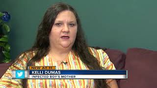 Teen infected with hookworms on Florida beach