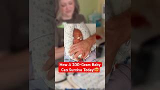This Baby Weighs Just 200 Grams!