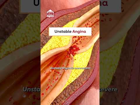 What does my chest pain mean?