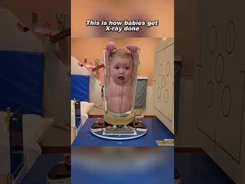 How a baby gets a x-ray