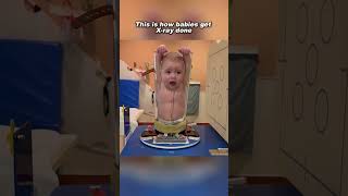 Download lagu How a baby gets a x-ray mp3 Download lagu How a baby gets a x-ray mp3