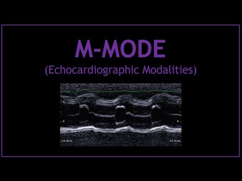 M-MODE (Echocardiographic Modalities)!