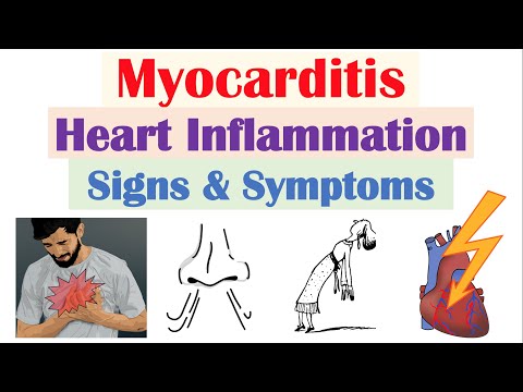Introduction to ECG The Basics ECG Paper PQRST wave Rate Rhythm Axis and Interval