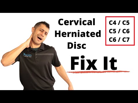 Cervical Herniated Disc Exercises for Neck Pain Relief