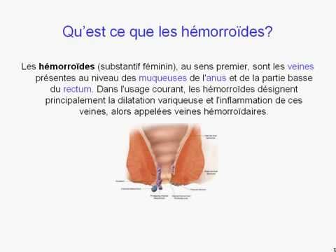 comment soulager sa thyroide