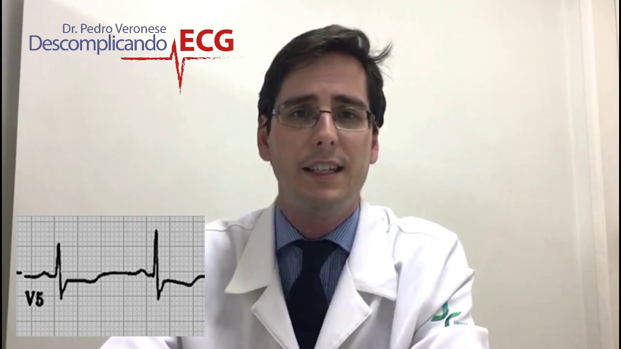 Dicas de ECG - Causas de infradesnivelamento do seguimento de ST